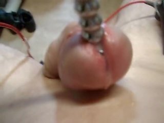 Electro זרע stimulation ejac electrotes sounding נַקָר ו - תחת