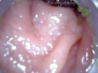 アナル endoscope パート 1, フリー 浣腸 罰 高解像度の 汚い ビデオ 04